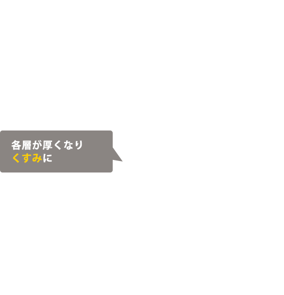 各層が厚くなりくすみに