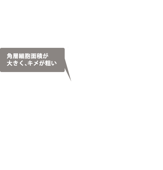 角層細胞面積が大きく、キメが粗い