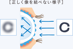 [正しく像を結べない様子]