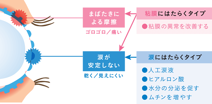 まばたきによる摩擦（ゴロゴロ/痛い）【目の粘膜にはたらく目薬】粘膜の異常を改善する目薬　涙が安定しない（乾く/見えにくい）【涙にはたらく目薬】人工涙液の目薬・ヒアルロン酸の目薬・水分の分泌を促す目薬・ムチンを増やす目薬