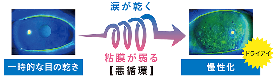 ドライアイが引き起こす悪循環