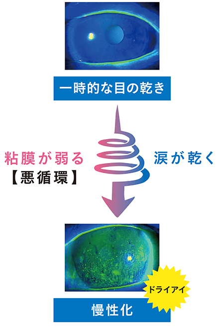 ドライアイが引き起こす悪循環