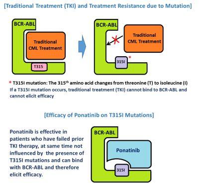 Traditional Treatment (TKI) and Treatment Resistance due to Mutation / Efficacy of Ponatinib on T315I Mutations