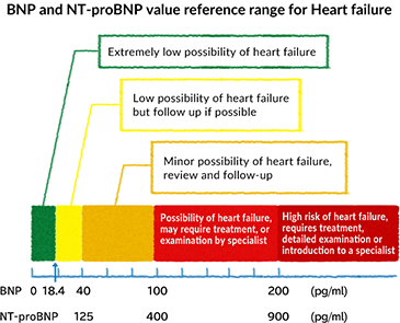 BNP and NT-proBNP value reference range for Heart failure
