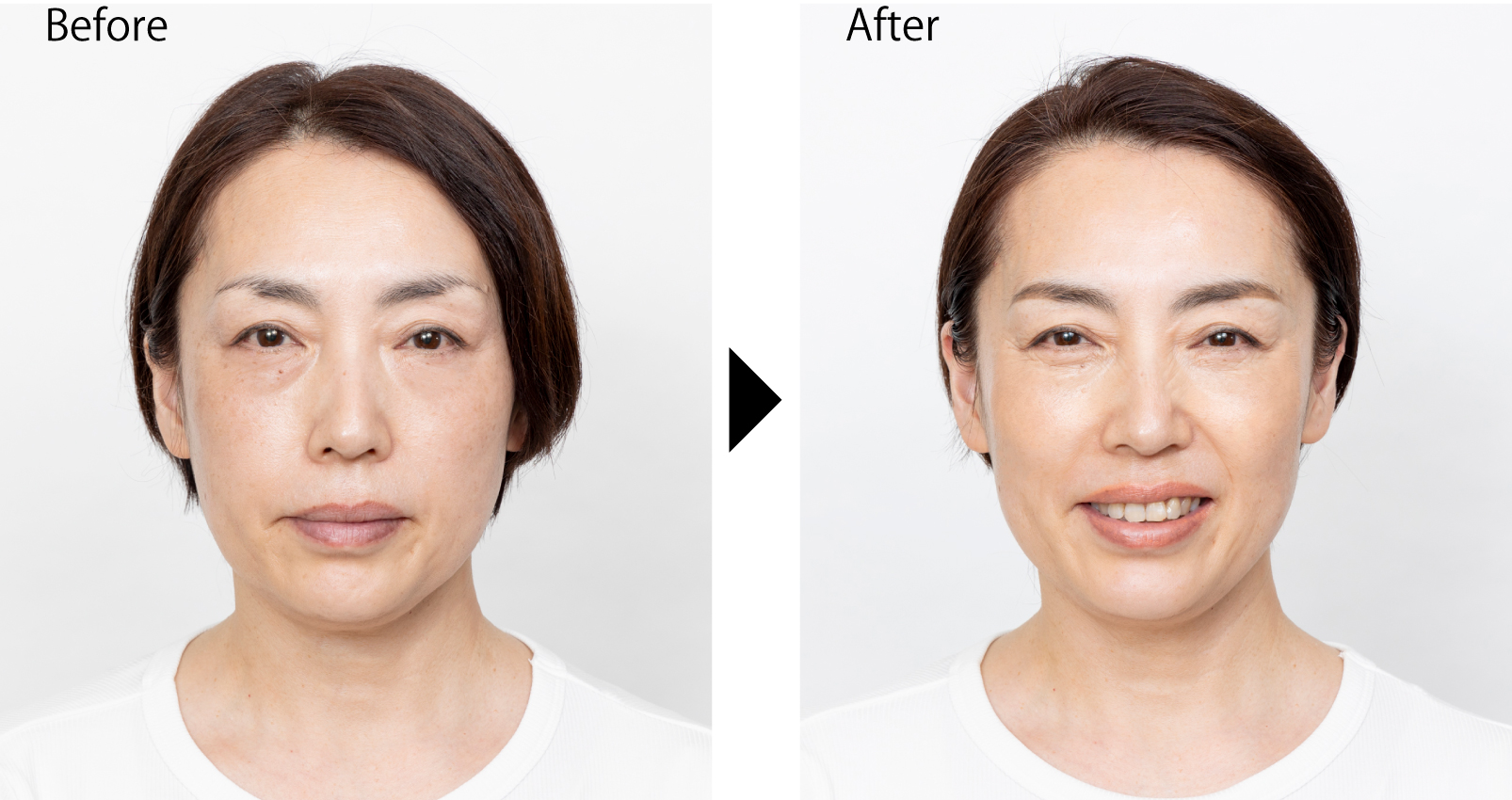 第36回　【ゴルゴライン対策】引き上げマッサージとコンシーラー／メイクアップアーティスト レイナさんの【人生が変わるメイク】