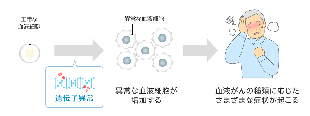 正常な血液細胞 遺伝子異常 異常な血液細胞 異常な血液細胞が増加する 血液がんの種類に応じたさまざまな症状が起こる