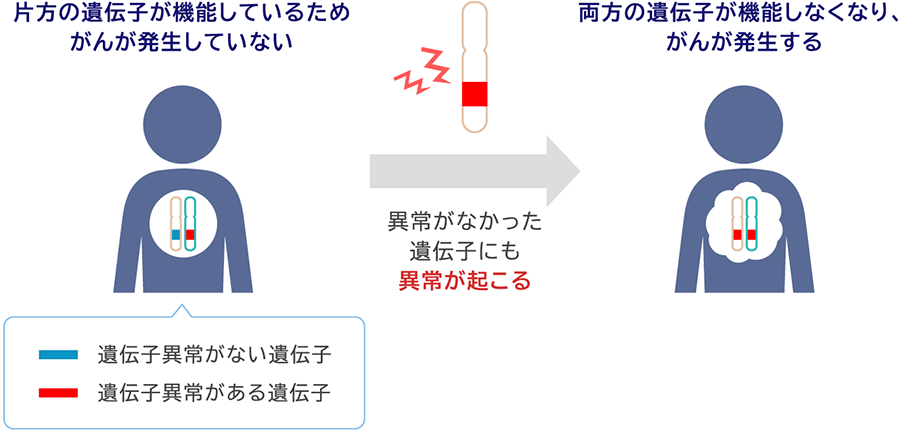 片方の遺伝子が機能しているためがんが発生していない 遺伝子異常がない遺伝子 遺伝子異常がある遺伝子 異常がなかった遺伝子にも異常が起こる 両方の遺伝子が機能しなくなり、がんが発生する