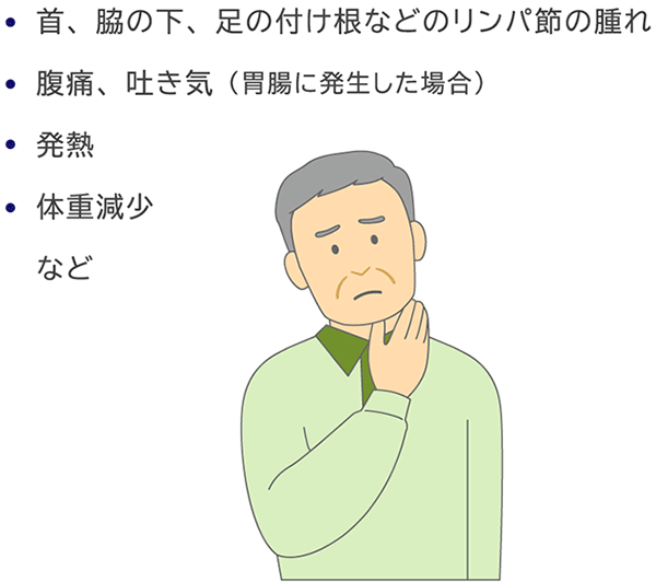 ・首、脇の下、足の付け根などのリンパ節の腫れ ・腹痛、吐き気（胃腸に発生した場合） ・発熱 ・体重減少 など