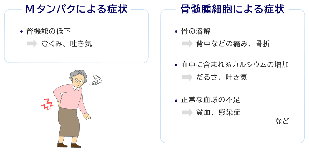 Mタンパクによる症状 腎機能の低下 むくみ、吐き気 骨髄腫細胞による症状 骨の溶解 背中などの痛み、骨折 血中に含まれるカルシウムの増加 だるさ、吐き気 正常な血球の不足 貧血、感染症など