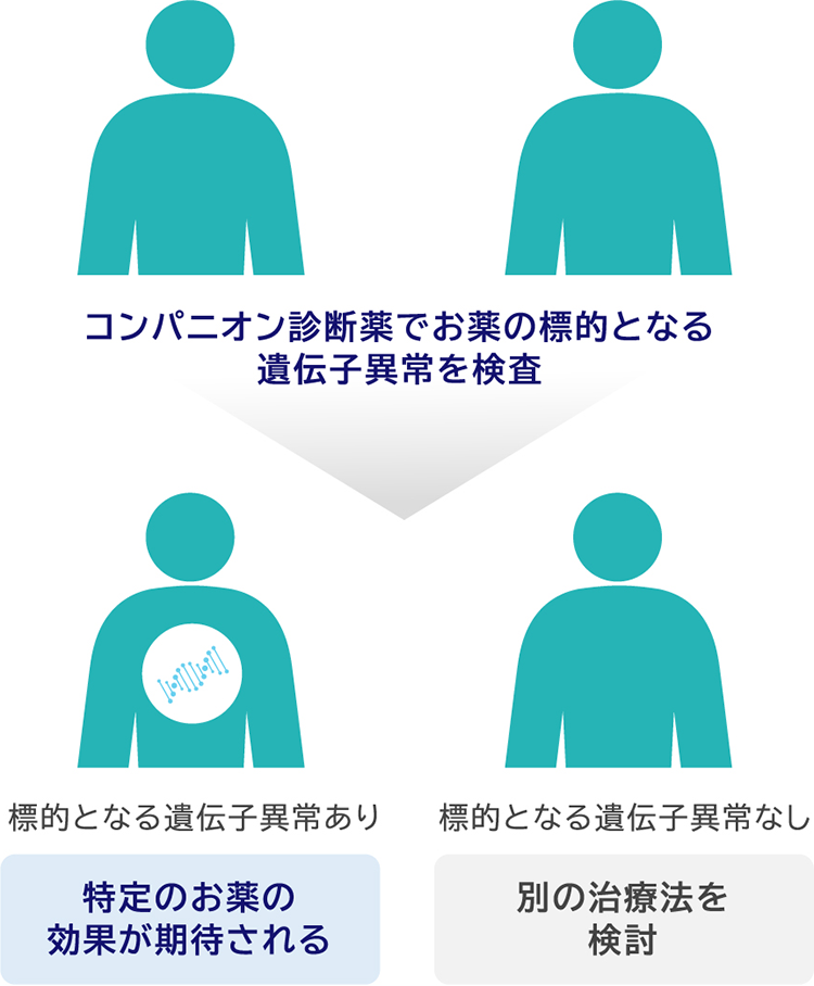 コンパニオン診断薬でお薬の標的となる遺伝子異常を検査 標的となる遺伝子異常あり 特定のお薬の効果が期待される 標的となる遺伝子異常なし 別の治療法を検討