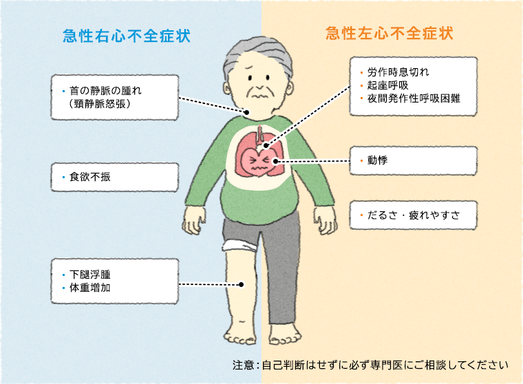 症状 心不全 うっ血 性