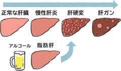 肝臓の役割と肝臓の病気 大塚製薬
