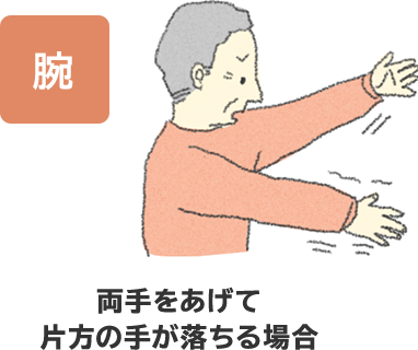 脳卒中の症状は 大塚製薬 脳卒中の症状は 大塚製薬