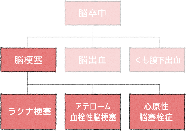 血栓 性 梗塞 アテローム 脳