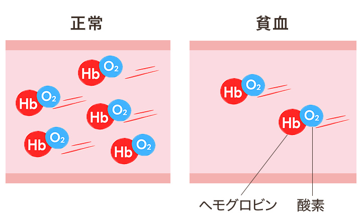 正常時と貧血時の酸素供給能力の違い