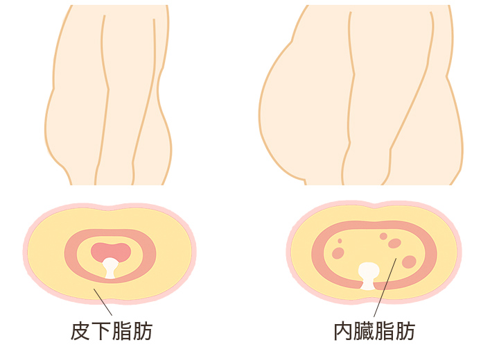 皮下脂肪と内臓脂肪