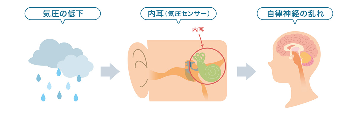 天気痛のメカニズム