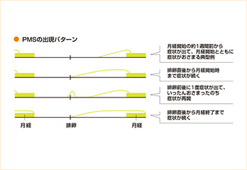 PMSの出現パターン