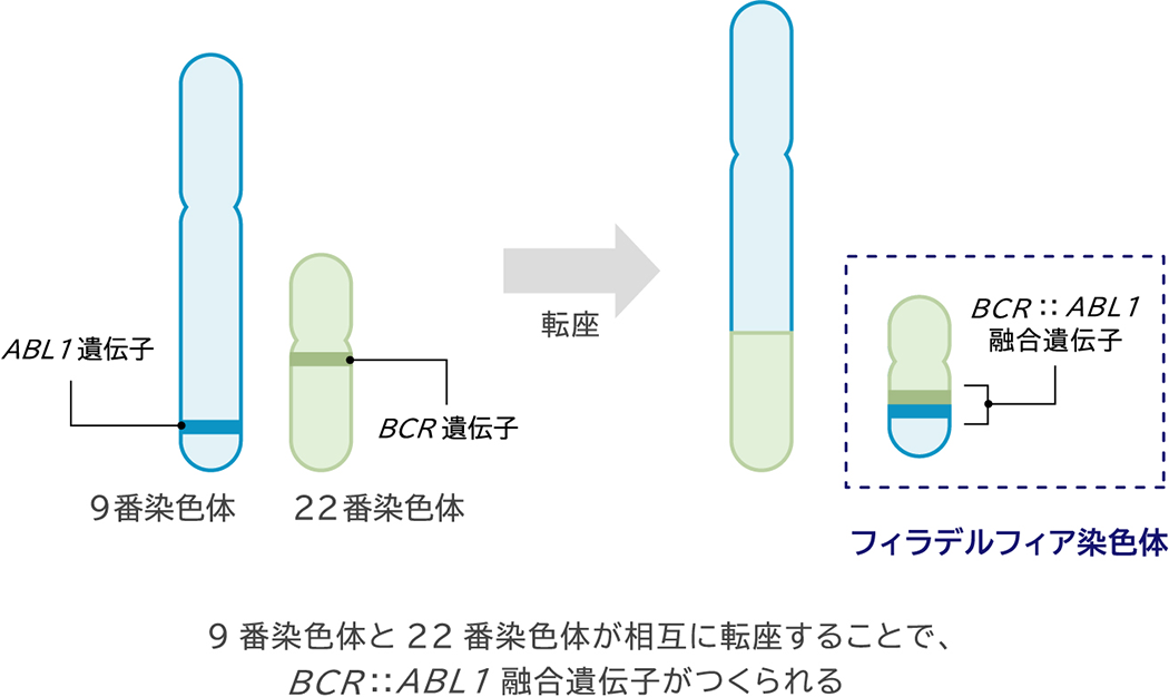 9番染色体と22番染色体が相互に転座することで、BCR::ABL1融合遺伝子がつくられる